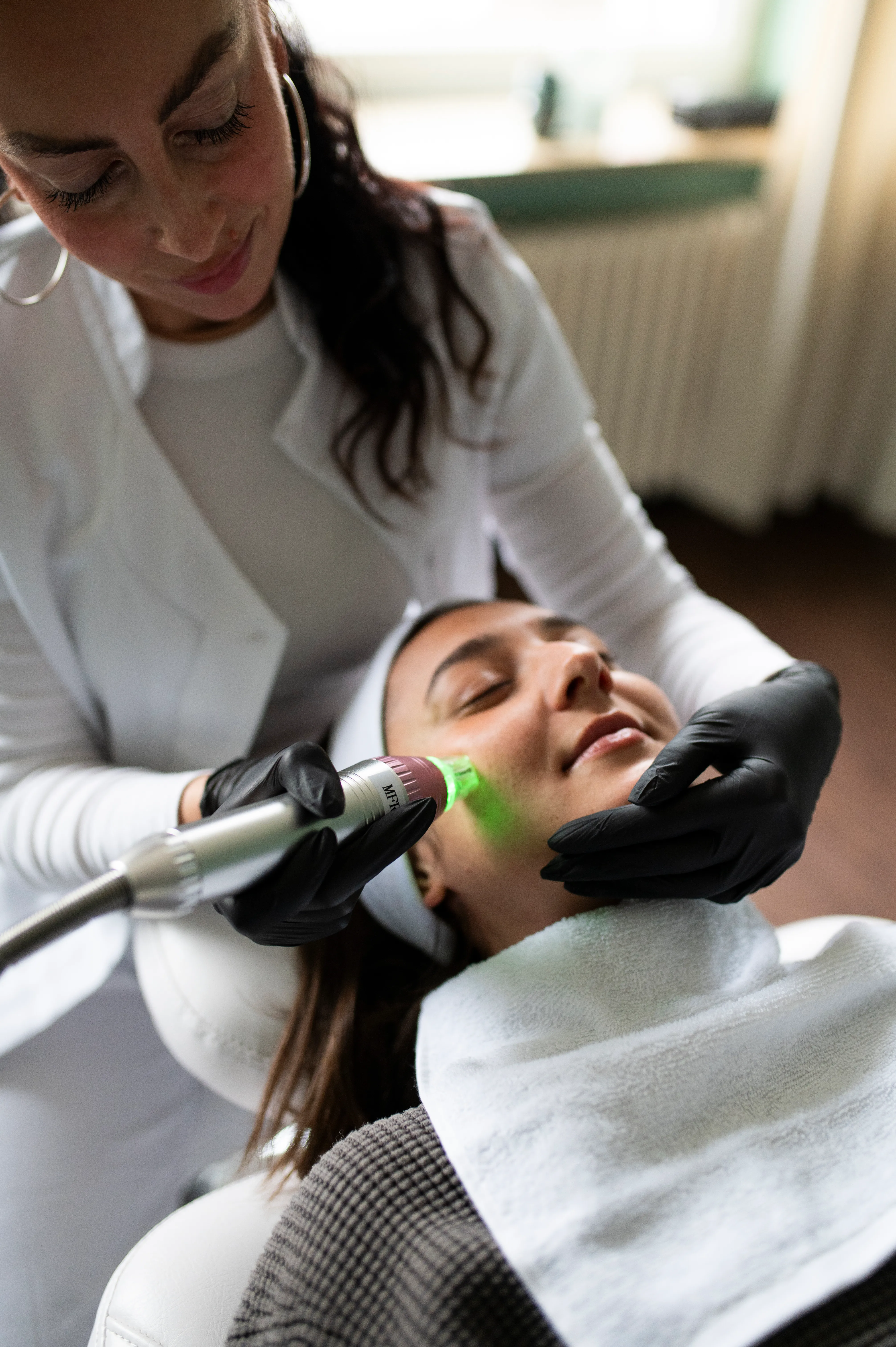 Was ist Microneedling mit Radiofrequenz?